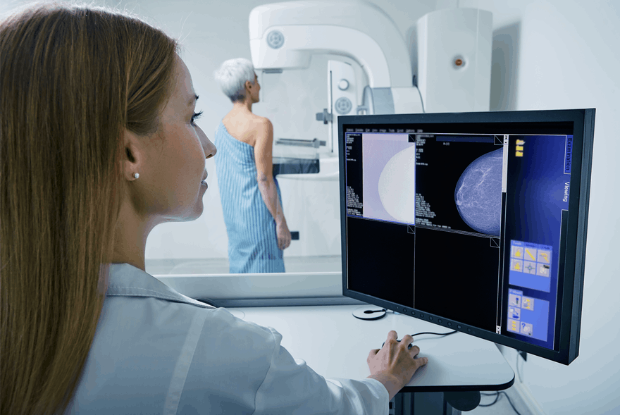 AI and digital mammography (DM) 